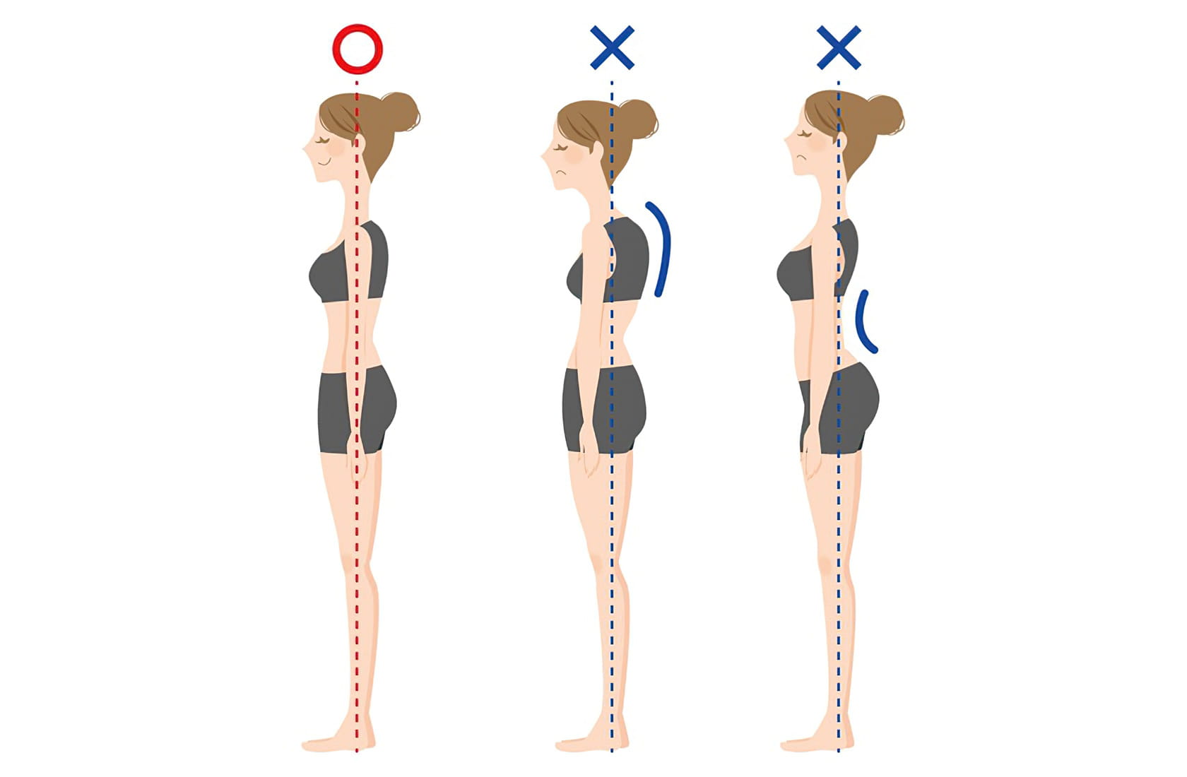 Posture concern